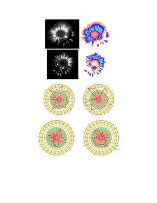 The Principles of Bio-Well Analysis Based on Kirlian Photography | PDF