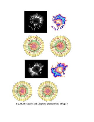 Fig.35. Bio-grams and Diagrams characteristic of type 4
 