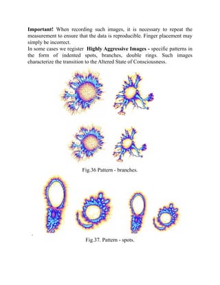 Important! When recording such images, it is necessary to repeat the
measurement to ensure that the data is reproducible. Finger placement may
simply be incorrect.
In some cases we register Highly Aggressive Images - specific patterns in
the form of indented spots, branches, double rings. Such images
characterize the transition to the Altered State of Consciousness.
Fig.36 Pattern - branches.
.
Fig.37. Pattern - spots.
 