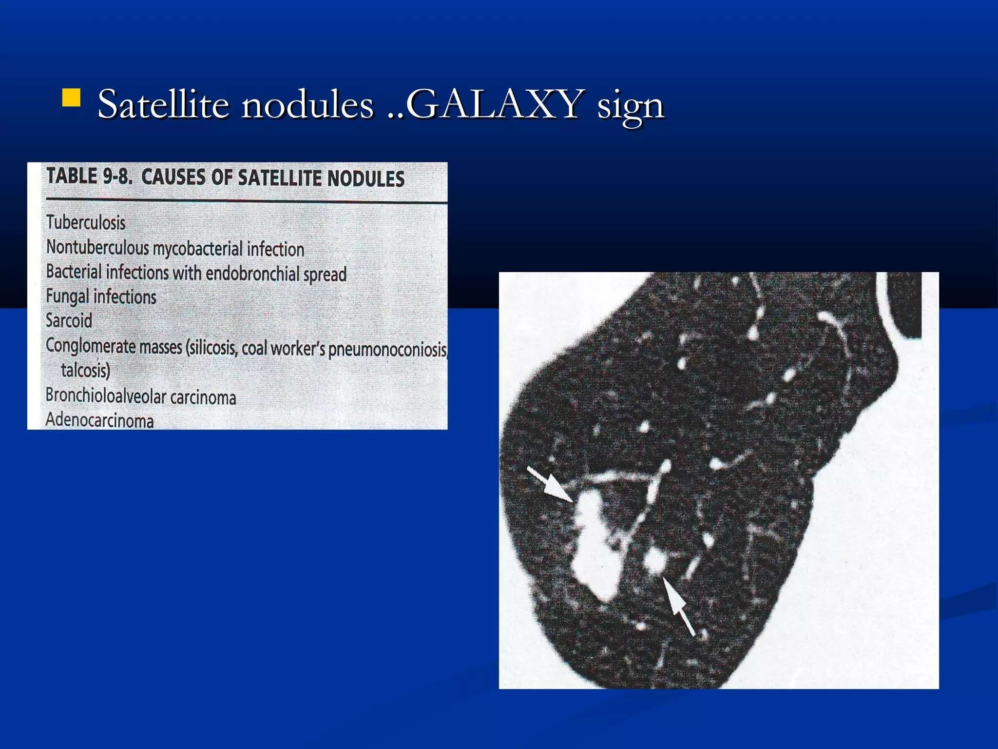    Satellite nodules ..GALAXY sign
 
