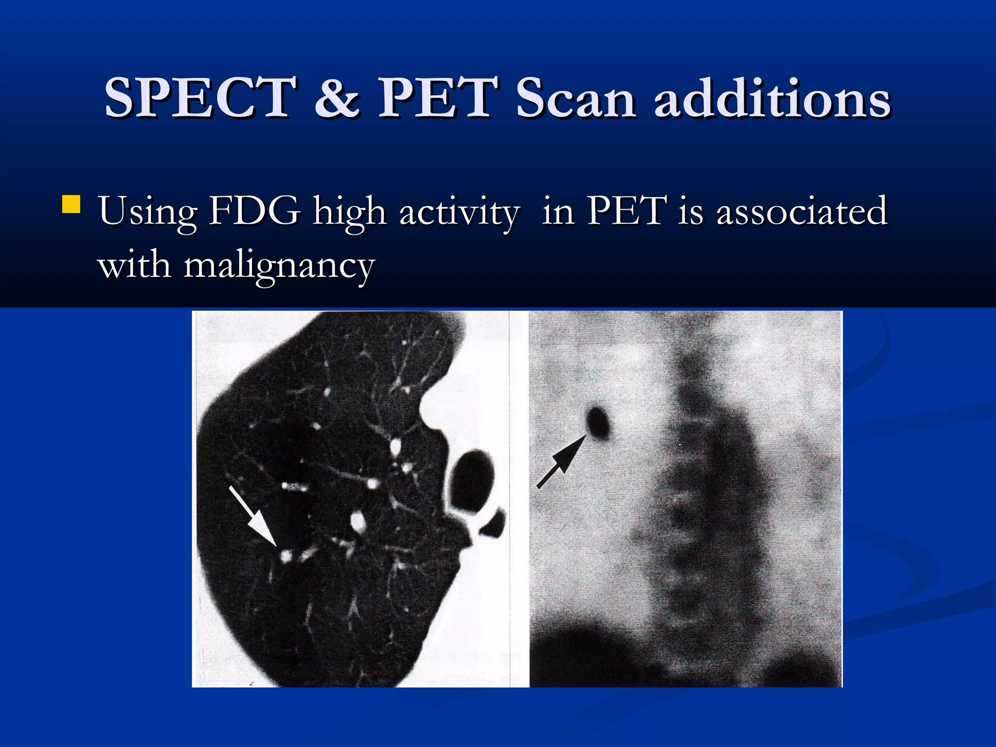 SPECT & PET Scan additions
   Using FDG high activity in PET is associated
    with malignancy
 