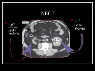 The problem of upper abdominal pain | PPT