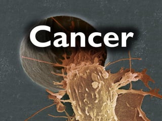 Cancer
 
