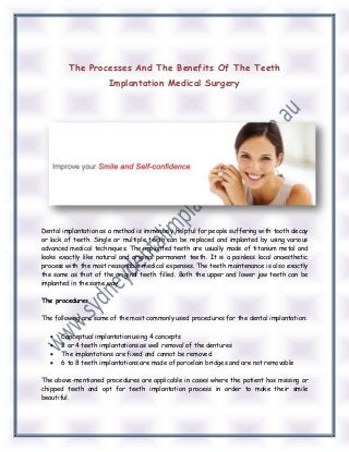 The Processes And The Benefits Of The Teeth Implantation Medical Surgery