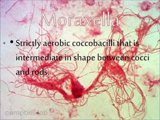 • Strictly aerobic coccobacilli that is
intermediatein shape between cocci
and rods.
 