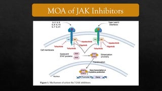 The Promise and Pitfalls of JAK Inhibitors in Inflammatory Bowel ...