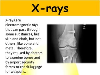 X-rays are
electromagnetic rays
that can pass through
some substances, like
skin and cloth, but not
others, like bone and
metal. Therefore,
they’re used by doctors
to examine bones and
by airport security
forces to check luggage
for weapons.
X-rays
 