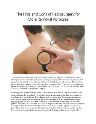 The Pros and Cons of Radiosurgery for
Mole Removal Purposes
A mole is a facial blemish that can have cosmetic effects on a person as well as health effects.
Many people have moles that grow in size as they age. The growth can cause the person to feel
insecure about himself or herself if the mole grows to be large and is located on the face. Some
people have moles on their chins, noses and other areas of the face. They can be unsightly to the
person who has them. Furthermore, some moles can develop cancers, one can usually find out if
a mole is cancerous by taking a quick biopsy.
Radiology is a new procedure by which a specialist uses a laser to rid someone of a mole. The
doctor performs the procedure by giving the patient an anesthetic. After the doctor applies the
anesthetic, he or she will use a device that runs off of radio waves. The device cuts away the
mole without causing any harms to the tissue that surrounds it. Many benefits exist to using
radiosurgery to remove a mole. One of the main benefits of using radiosurgery is that it is a
painless procedure. The anesthetic takes care of the pain that would normally be associated with
such a procedure. Another benefit of the procedure is that it is quick. A patient can have the
procedure done in a few hours and then spend the rest of the day recovering. Another positive
aspect of radiosurgery is that the scarring is minimal. Other procedures leave room for the
 