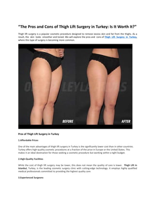 “The Pros and Cons of Thigh Lift Surgery in Turkey: Is It Worth It?”
Thigh lift surgery is a popular cosmetic procedure designed to remove excess skin and fat from the thighs. As a
result, the skin looks smoother and toned. We will explore the pros and cons of Thigh Lift Surgery in Turkey,
where this type of surgery is becoming more common.
Pros of Thigh Lift Surgery in Turkey
1.Affordable Prices
One of the main advantages of thigh lift surgery in Turkey is the significantly lower cost than in other countries.
Turkey offers high-quality cosmetic procedures at a fraction of the price in Europe or the United States. This
makes it an ideal destination for those seeking a cosmetic procedure but working within a tight budget.
2.High-Quality Facilities
While the cost of thigh lift surgery may be lower, this does not mean the quality of care is lower. Thigh Lift in
Istanbul, Turkey, is the leading cosmetic surgery clinic with cutting-edge technology. It employs highly qualified
medical professionals committed to providing the highest quality care.
3.Experienced Surgeons
 
