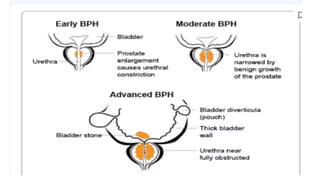 The Prostate - anatomy lecture about human gland | PPTX