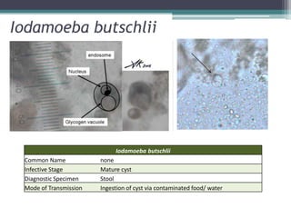 Iodamoeba butschlii




                             Iodamoeba butschlii
 Common Name            none
 Infective Stage        Mature cyst
 Diagnostic Specimen    Stool
 Mode of Transmission   Ingestion of cyst via contaminated food/ water
 