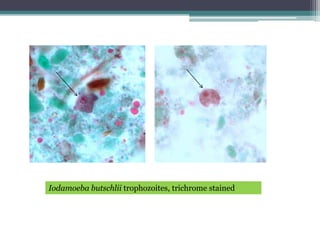 Iodamoeba butschlii trophozoites, trichrome stained
 