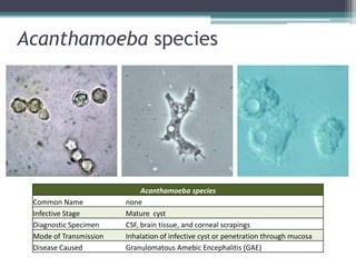 Acanthamoeba species




                             Acanthamoeba species
 Common Name            none
 Infective Stage        Mature cyst
 Diagnostic Specimen    CSF, brain tissue, and corneal scrapings
 Mode of Transmission   Inhalation of infective cyst or penetration through mucosa
 Disease Caused         Granulomatous Amebic Encephalitis (GAE)
 