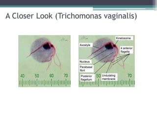 A Closer Look (Trichomonas vaginalis)
 