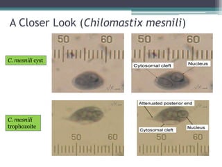 A Closer Look (Chilomastix mesnili)


C. mesnili cyst




C. mesnili
trophozoite
 