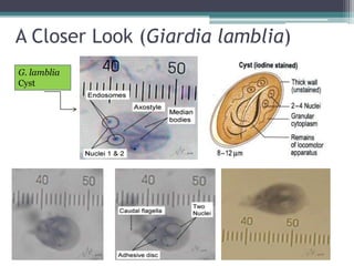 A Closer Look (Giardia lamblia)
G. lamblia
Cyst
 