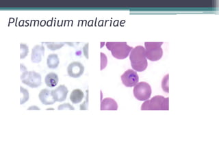 Plasmodium malariae
 