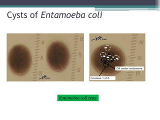 Cysts of Entamoeba coli




            Entamobea coli cysts
 