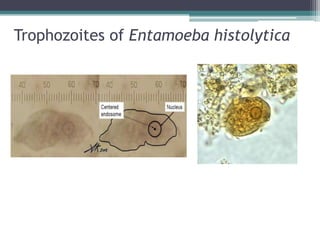 Trophozoites of Entamoeba histolytica
 