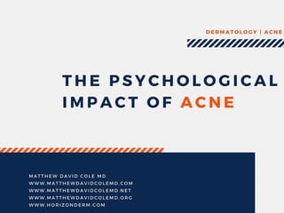 The Psychological Impact of Acne by Matthew David Cole MD