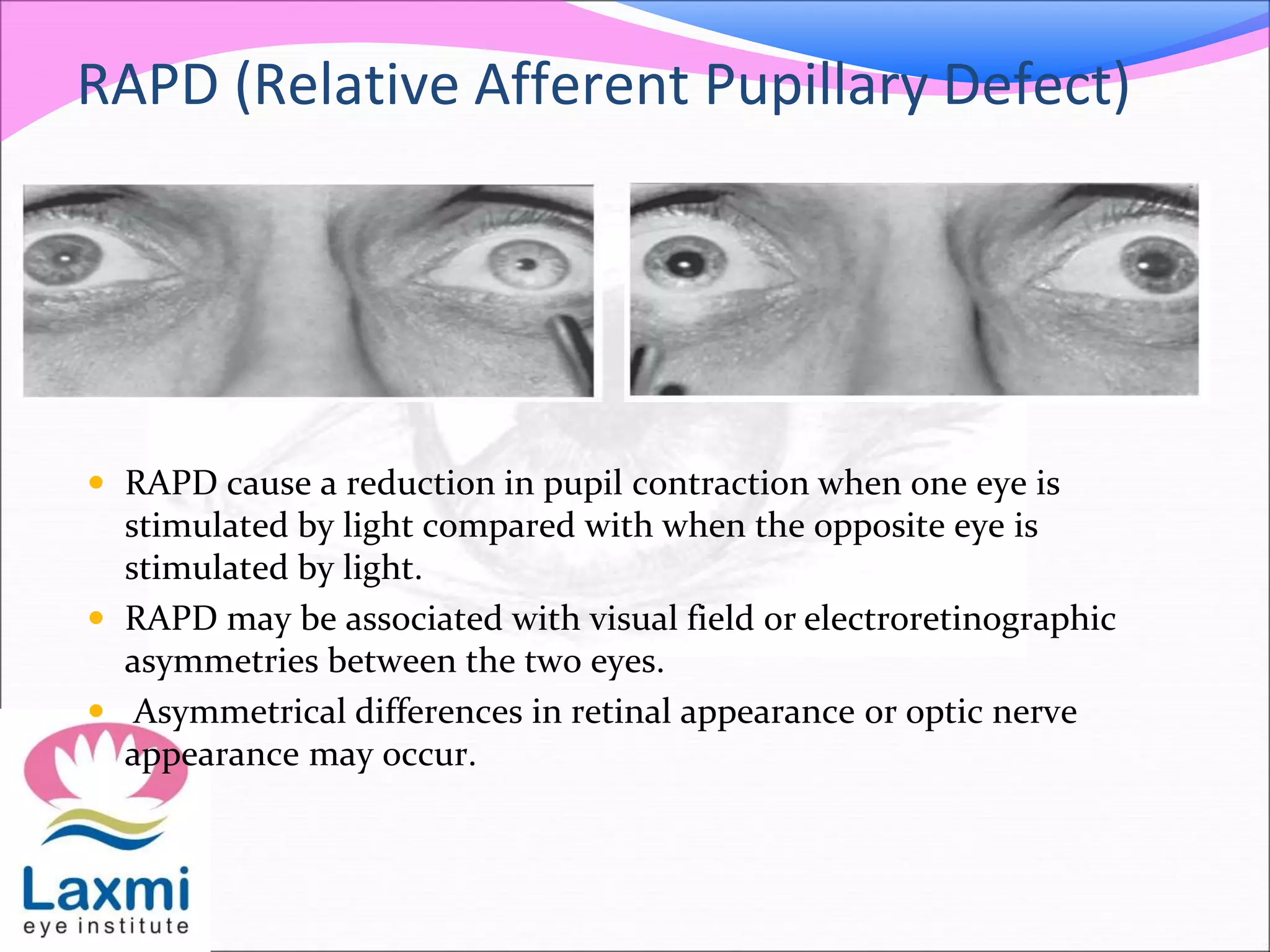 The Pupillary Pathway And Its Clinical Aspects PPTX