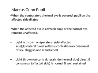 Marcus Gunn Pupil
-When the contralateral/normal eye is covered, pupil on the
affected side dilates
-When the affected eye is covered pupil of the normal eye
remains unaffected.
– Light is thrown on ipsilateral side(affected
side);Ipsilateral direct reflex & contralateral consensual
reflex- sluggish and ill sustained.
– Light thrown on contralateral side (normal side) direct &
consensual (affected side) is normal & well sustained
 