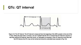 The q t interval | PPTX
