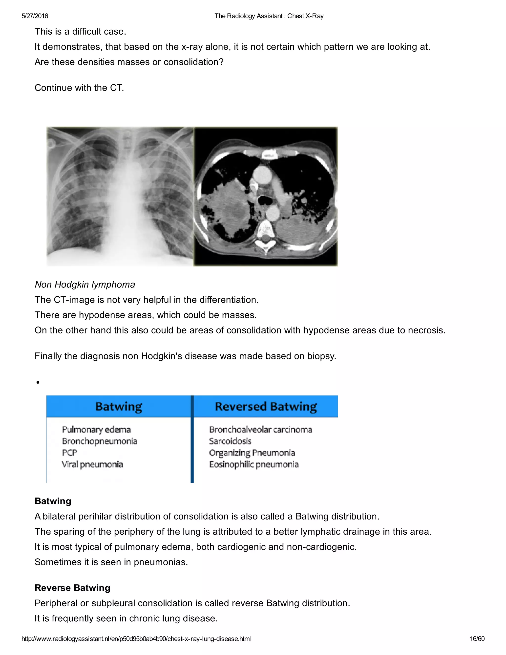 The radiology assistant chest x ray - lung disease | PDF