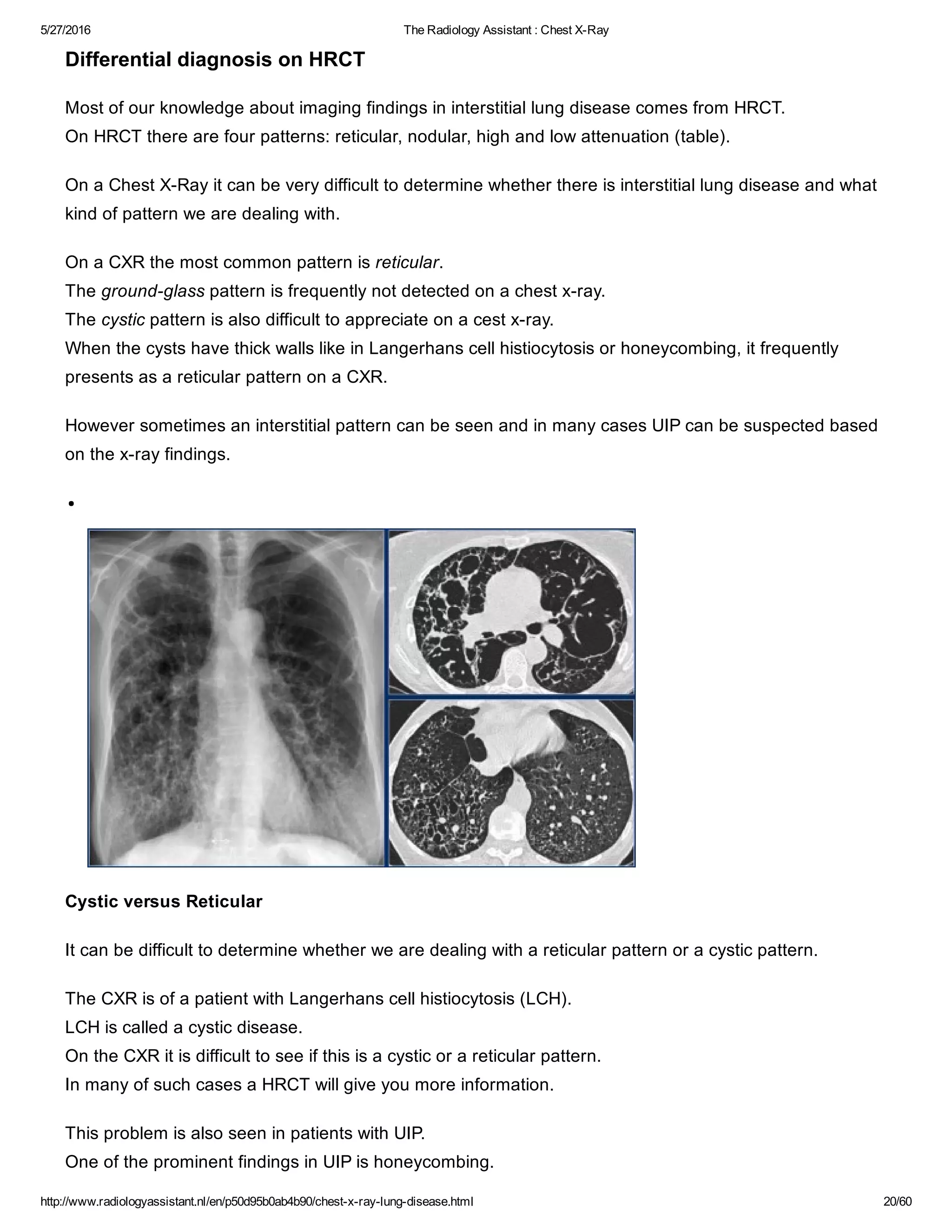 The radiology assistant chest x ray - lung disease | PDF