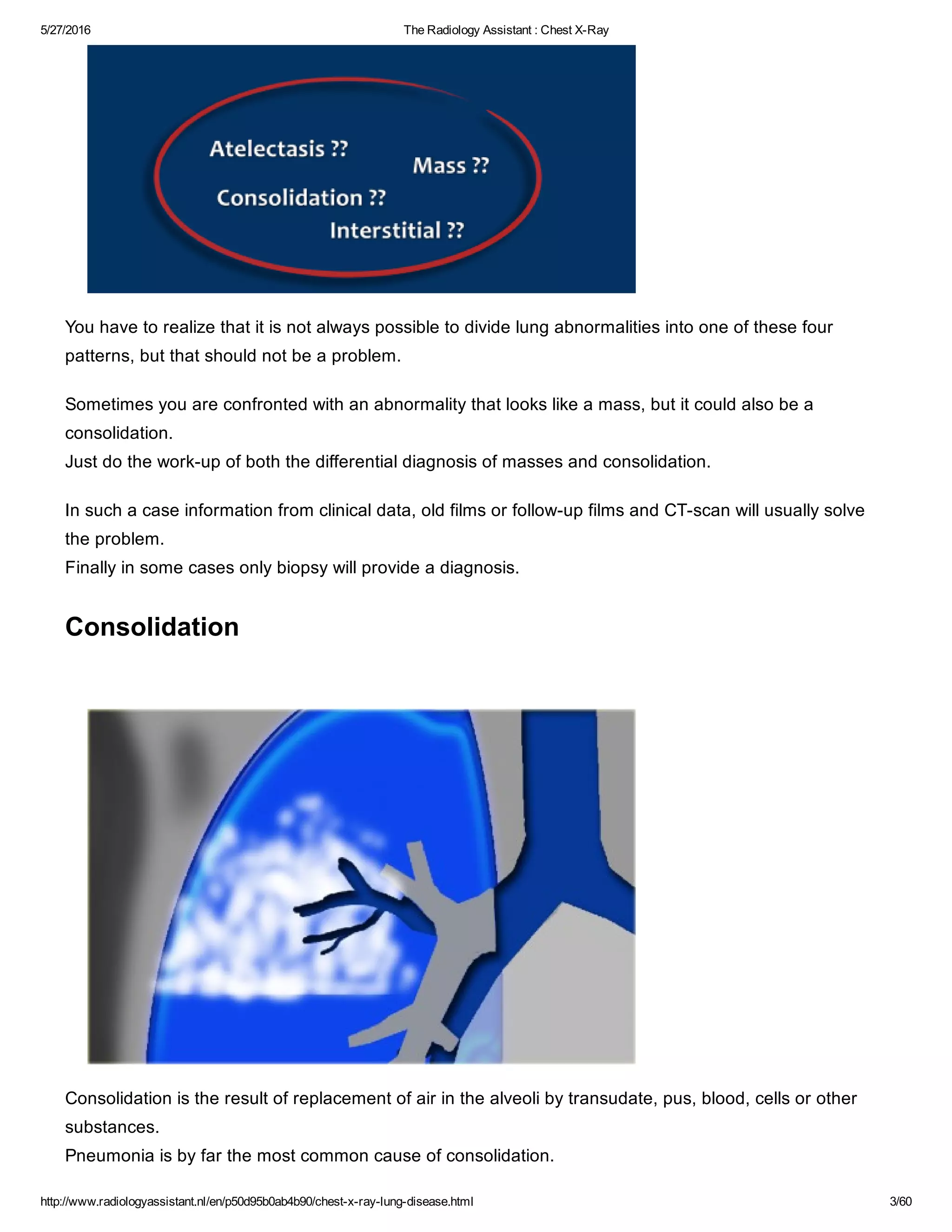 The radiology assistant chest x ray - lung disease | PDF