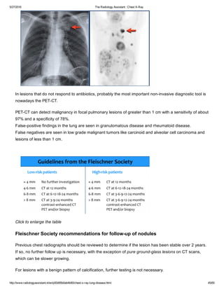 The radiology assistant chest x ray - lung disease | PDF