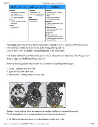 The radiology assistant chest x ray - lung disease | PDF