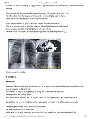 The radiology assistant chest x ray - lung disease | PDF