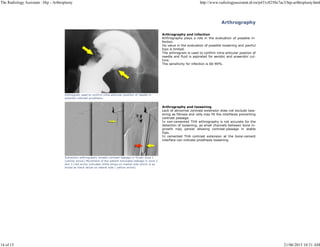 The radiology assistant hip arthroplasty | PDF