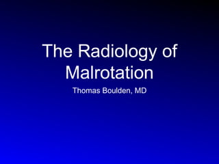 The Radiology of
Malrotation
Thomas Boulden, MD

 