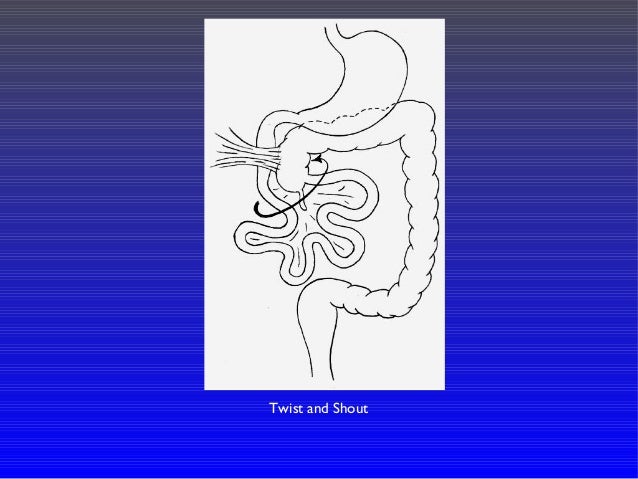 49+ Ligament Of Treitz On Right Side Gif