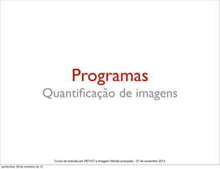 Programas

Quantiﬁcação de imagens

Curso de imersão em PET/CT e Imagem Hibrida avançada - 27 de novembro 2013
quinta-feira, 28 de novembro de 13

 