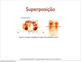 Superposição

Curso de imersão em PET/CT e Imagem Hibrida avançada - 27 de novembro 2013
quinta-feira, 28 de novembro de 13

 