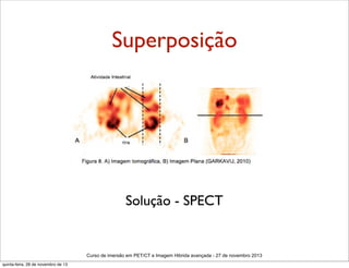 Superposição

Solução - SPECT

Curso de imersão em PET/CT e Imagem Hibrida avançada - 27 de novembro 2013
quinta-feira, 28 de novembro de 13

 