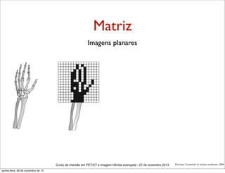 Matriz
Imagens planares

Curso de imersão em PET/CT e Imagem Hibrida avançada - 27 de novembro 2013
quinta-feira, 28 de novembro de 13

Powsner, Essentials of nuclear medicine, 2006

 