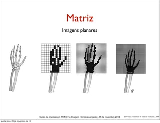 Matriz
Imagens planares

Curso de imersão em PET/CT e Imagem Hibrida avançada - 27 de novembro 2013
quinta-feira, 28 de novembro de 13

Powsner, Essentials of nuclear medicine, 2006

 
