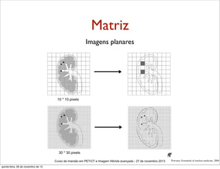 Matriz
Imagens planares

Curso de imersão em PET/CT e Imagem Hibrida avançada - 27 de novembro 2013
quinta-feira, 28 de novembro de 13

Powsner, Essentials of nuclear medicine, 2006

 