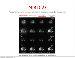 MIRD 23
Algoritmos de reconstrução e parâmetros de correção
Sem correção

Atenucação

Atenucação /
Espalhamento

Aten. / Esp.
CDR

Curso de imersão em PET/CT e Imagem Hibrida avançada - 27 de novembro 2013
quinta-feira, 28 de novembro de 13

 