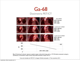 Ga-68
Dosimetria PET/CT

Curso de imersão em PET/CT e Imagem Hibrida avançada - 27 de novembro 2013
quinta-feira, 28 de novembro de 13

 