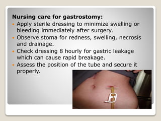 Nursing care for gastrostomy:
 Apply sterile dressing to minimize swelling or
bleeding immediately after surgery.
 Observe stoma for redness, swelling, necrosis
and drainage.
 Check dressing 8 hourly for gastric leakage
which can cause rapid breakage.
 Assess the position of the tube and secure it
properly.
 