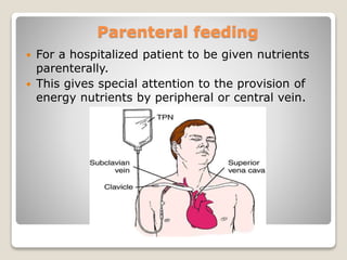 Parenteral feeding
 For a hospitalized patient to be given nutrients
parenterally.
 This gives special attention to the provision of
energy nutrients by peripheral or central vein.
 