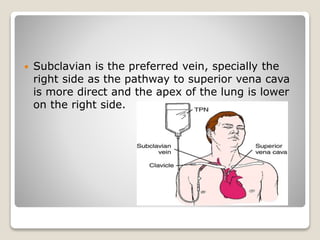  Subclavian is the preferred vein, specially the
right side as the pathway to superior vena cava
is more direct and the apex of the lung is lower
on the right side.
 