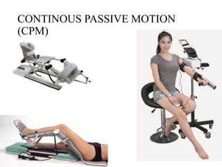 CONTINOUS PASSIVE MOTION
(CPM)
 
