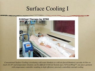 Surface Cooling I




  Conventional Surface Cooling (circulating cold water blankets or cold air-forced blankets) can take 4-8 hrs to
reach 32-34° and temperature titration can be difﬁcult CritiCool System uses 3-D CureWrap™ one piece garment
          with temperature controller resulting in high efﬁciency precisely controlled external cooling
 