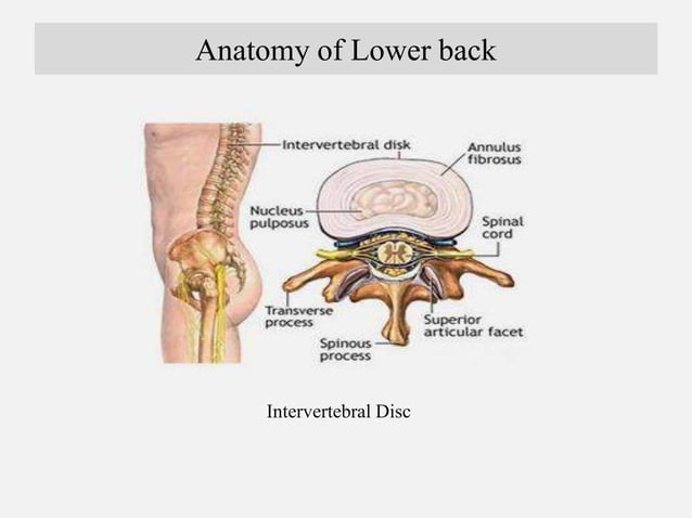 Therapeutic management for Low Back Pain by Dr Arman Hossain | PPT
